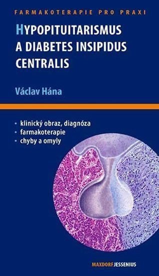 Hypopituitarismus a diabetes insipidus centralis – Hána Václav