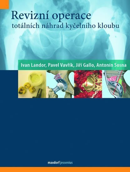 Revizní operace totálních náhrad kyčelního kloubu – group of authors