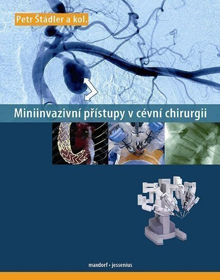 Miniinvazivní přístupy v cévní chirurgii – group of authors