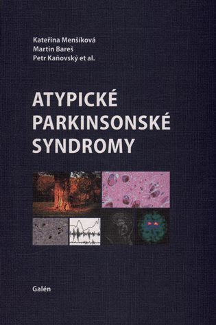 Atypické parkinsonské syndromy – Menšíková Kateřina