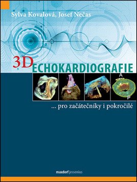 3D Echokardiografie – Kovalová Sylva