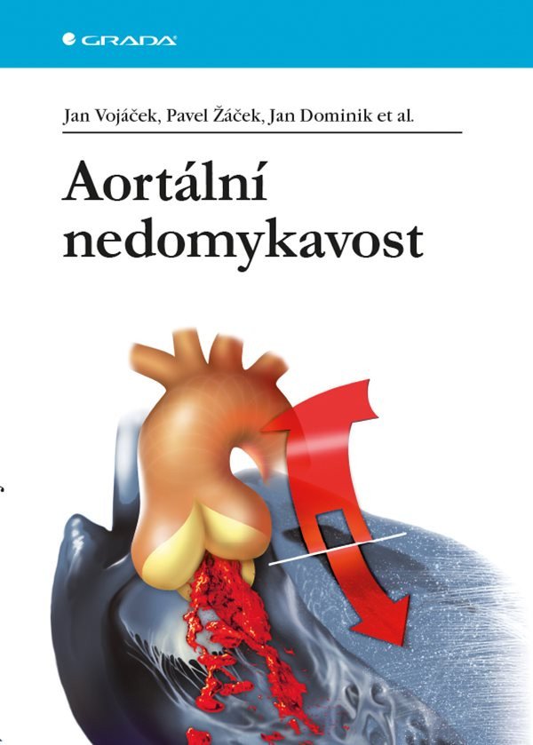 Aortální nedomykavost – Žáček Pavel