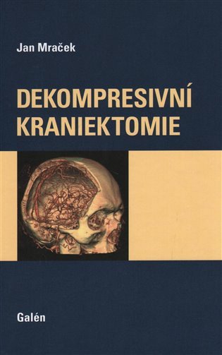Dekompresivní kraniektomie – Mraček Jan
