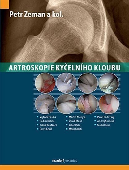 Artroskopie kyčelního kloubu – Zeman Petr
