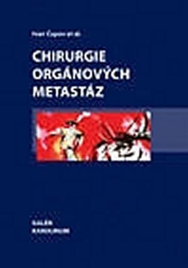 Chirurgie orgánových metastáz – Čapov Ivan