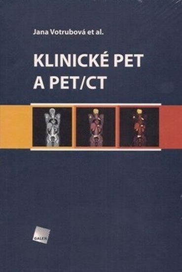 Klinické PET a PETCT – Votrubová Jana
