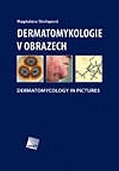 Dermatomykologie v obrazech - Dermatomycology in Pictures – Skořepová Magdalena (2011)