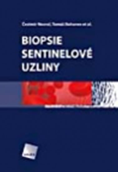 Biopsie sentinelové uzliny – Macho Adrián