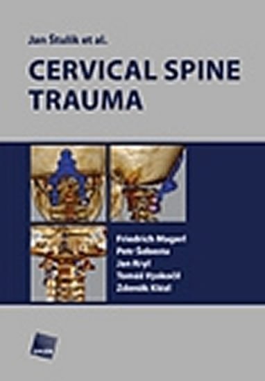 Cervical spine trauma – Štulík Jan