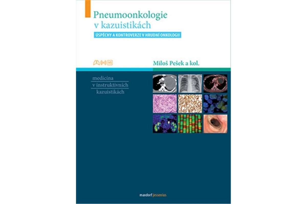 Pneumoonkologie v kazuistikách – group of authors