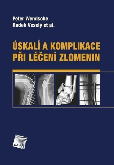 Úskalí a komplikace při léčení zlomenin – Wendsche Peter