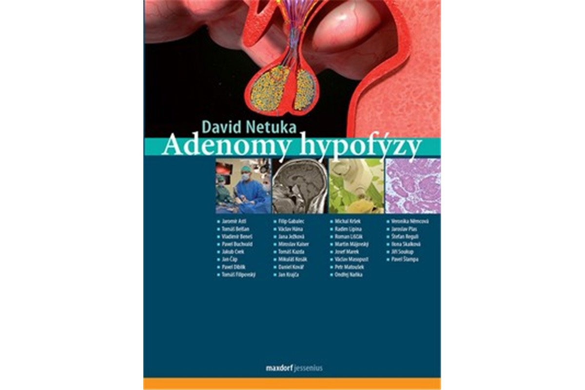 Adenomy hypofýzy – Netuka David