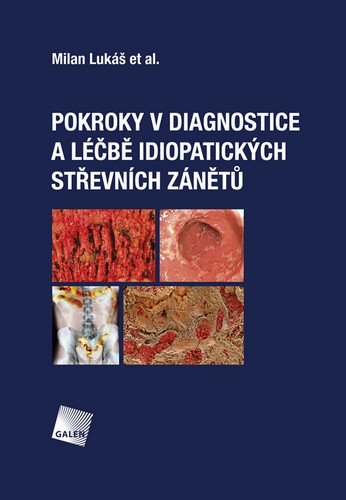 Pokroky v diagnostice a léčbě idiopatických střevních zánětů – Lukáš Milan
