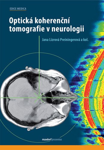 Optická koherenční tomografie v neurologii – group of authors