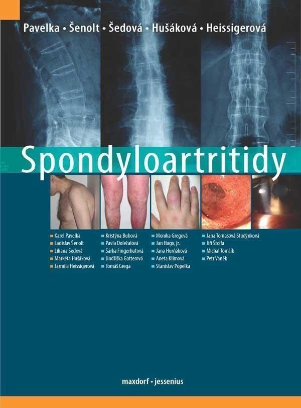 Spondyloartritidy – group of authors