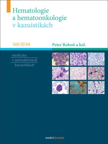 Hematologie a hematoonkologie v kazuistikách – Rohoň Peter