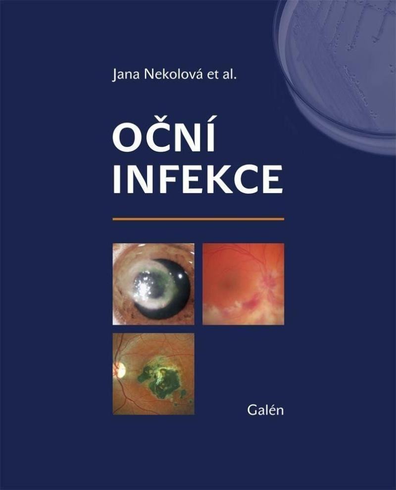 Oční infekce – Nekolová Jana