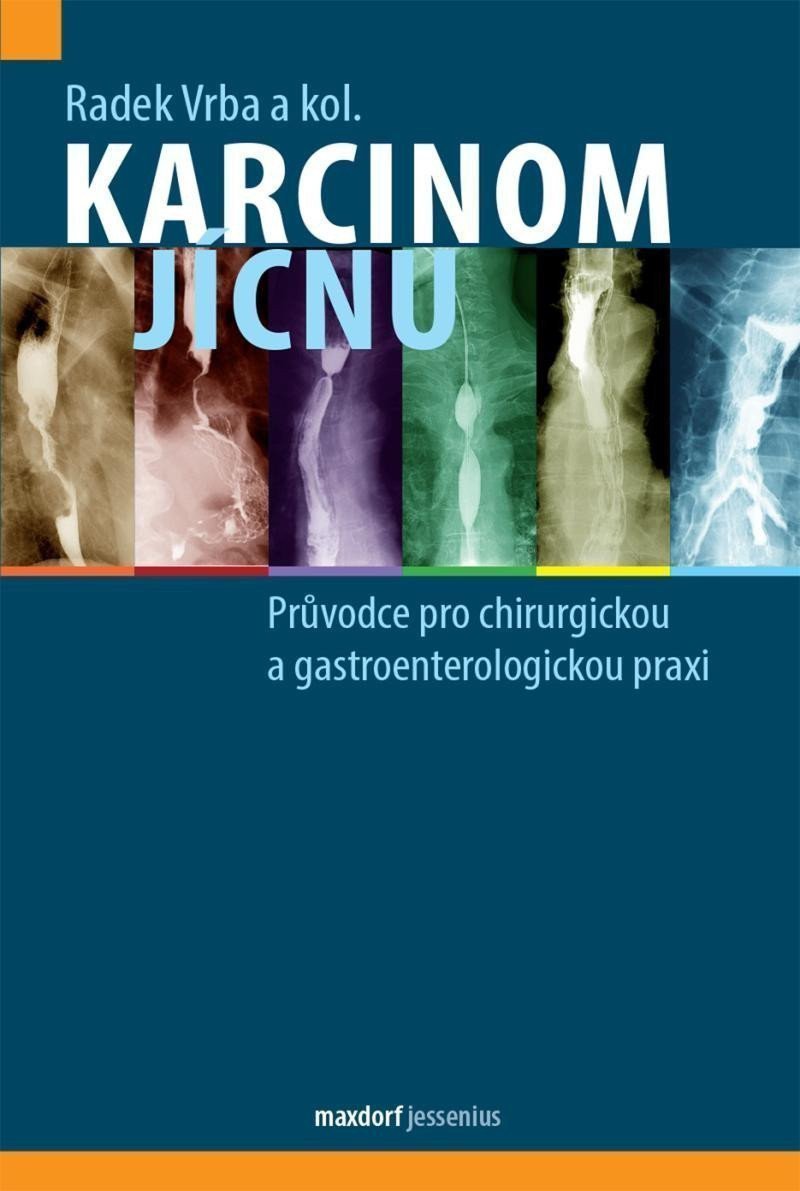 Karcinom jícnu - Průvodce pro chirurgickou a gastroenterologickou praxi – Vrba Radek