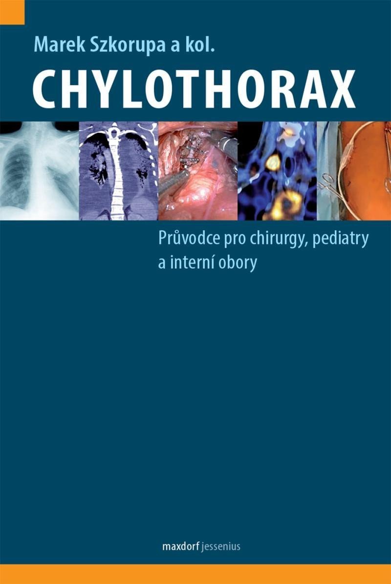 Chylothorax - Průvodce pro chirurgy pediatry a interní obory – Szkorupa Marek