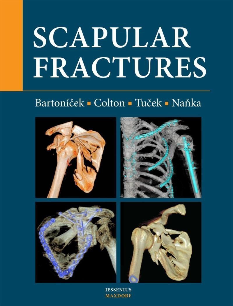 Scapular fractures – Naňka Ondřej
