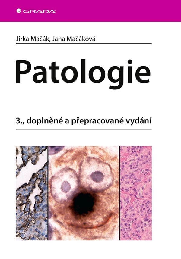 Patologie – Mačák Jirka
