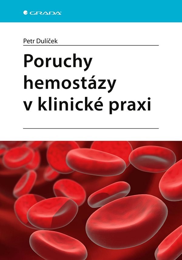 Poruchy hemostázy v klinické praxi – Dulíček Petr