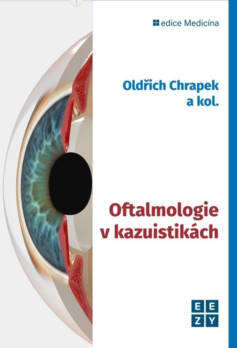 Oftalmologie v kazuistikách – Chrapek Oldřich