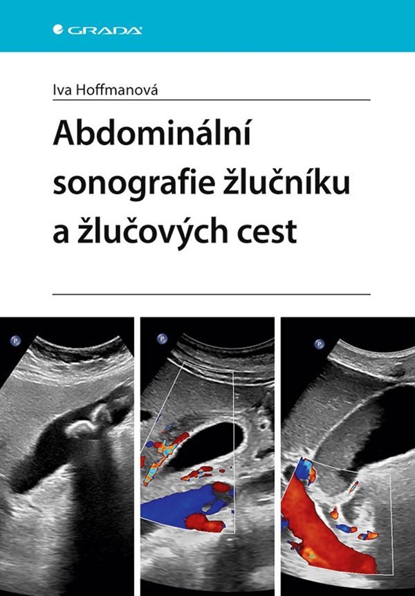 Abdominální sonografie žlučníku a žlučových cest – Hoffmanová Iva