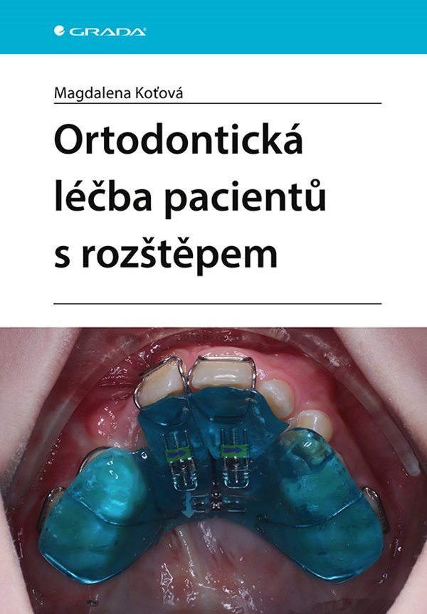 Ortodontická léčba pacientů s rozštěpem – Koťová Magdalena