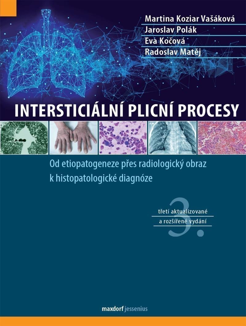 Intersticiální plicní procesy – Koziar Vašáková Martina