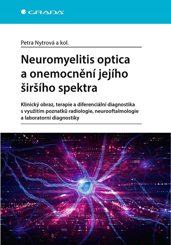Neuromyelitis optica a poruchy jejího širšího spektra – Nytrová Petra