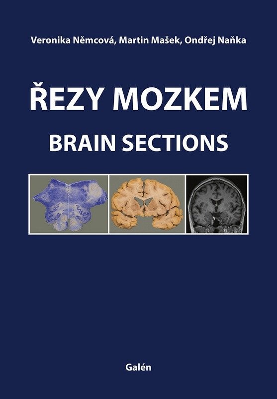 Řezy mozkem Brain Sections – Naňka Ondřej