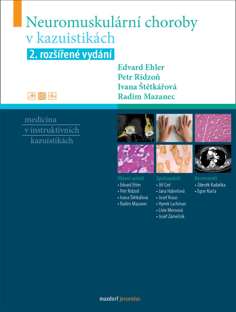 Neuromuskulární choroby v kazuistikách – Štětkářová Ivana