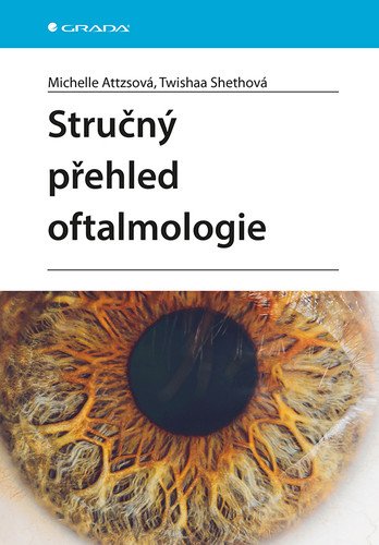 Stručný přehled oftalmologie (2026)