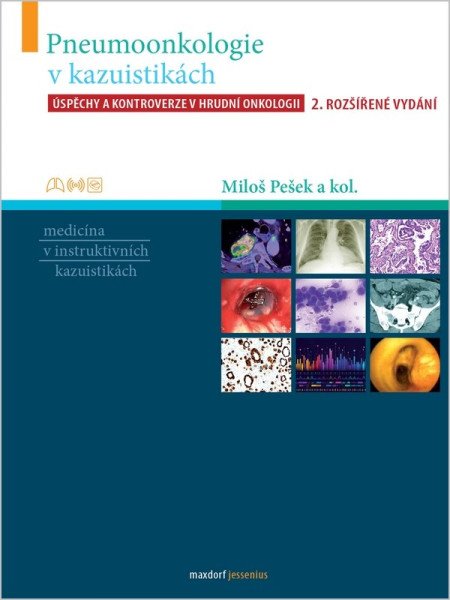 Pneumoonkologie v kazuistikách - Úspěchy a kontroverze v hrudní chirurgii (2026)
