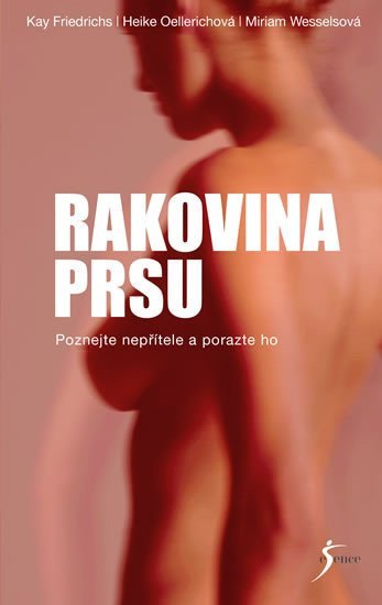 Rakovina prsu – kolektiv autorů