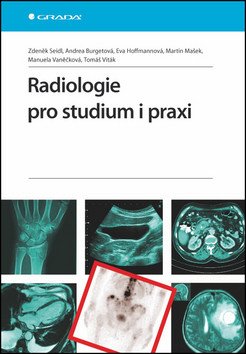 Radiologie pro studium i praxi – Seidl Zdeněk