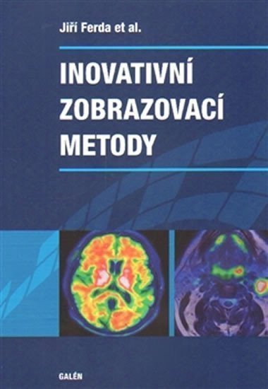Inovativní zobrazovací metody – group of authors