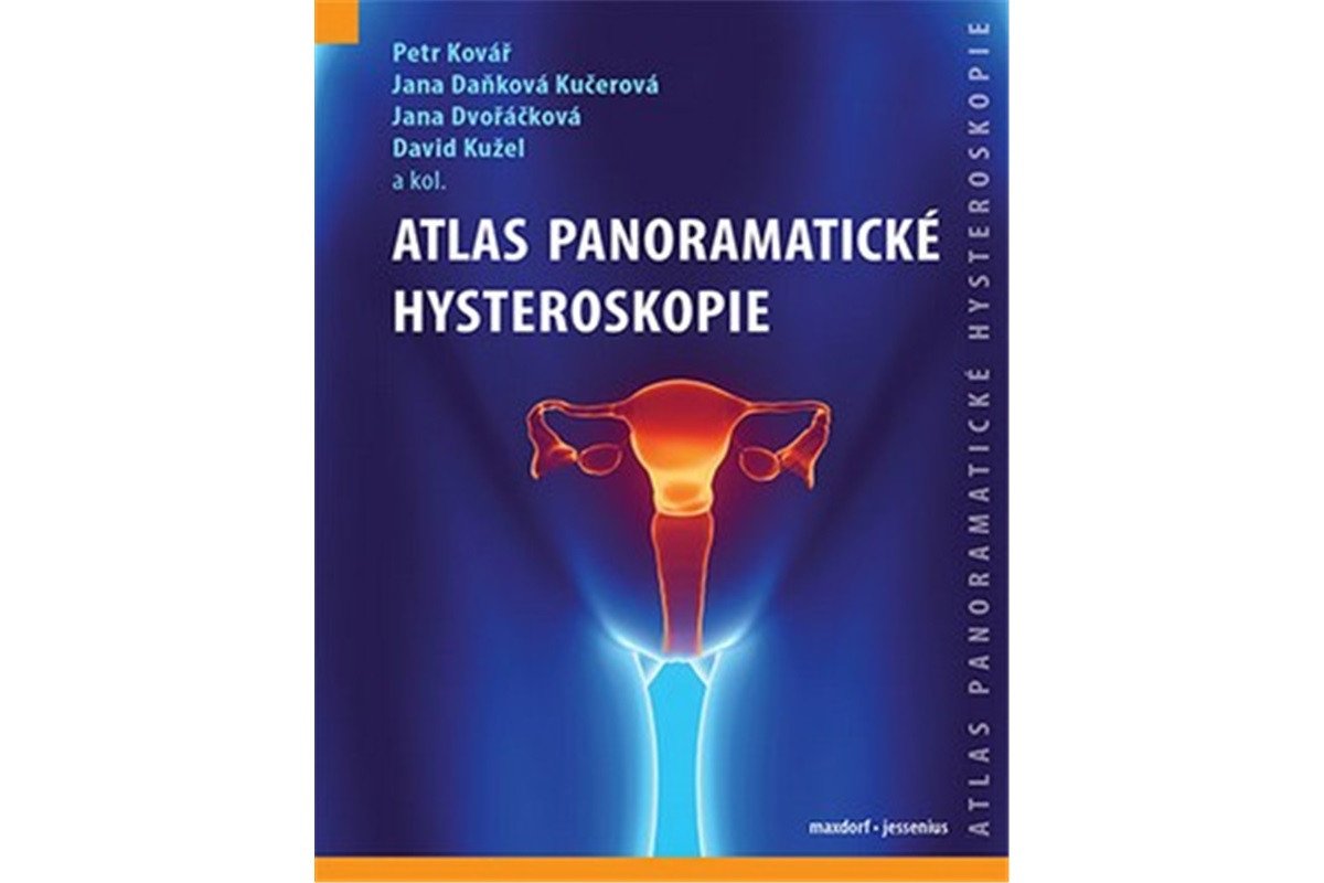 Atlas panoramatické hysteroskopie – group of authors