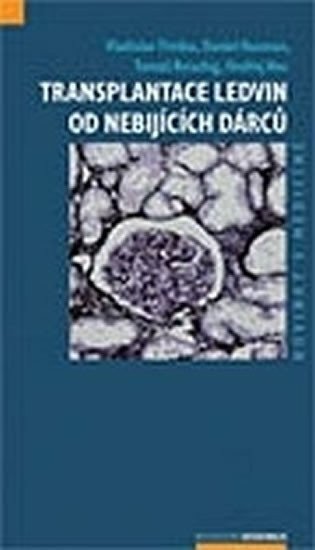 Transplantace ledvin od nebijících dárců – group of authors