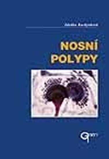 Nosní polypy – Kuchynková Zdeňka