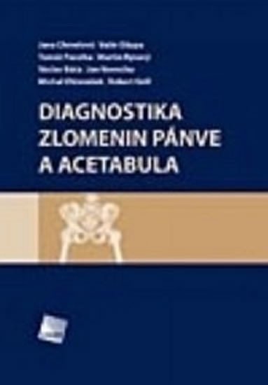 Diagnostika zlomenin pánve a acetabula – Vavrečka Jan