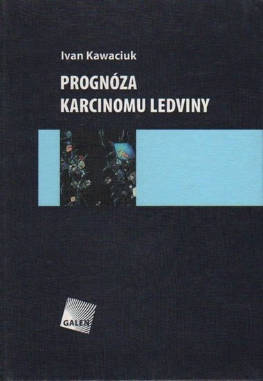 Prognóza karcinomu ledviny – Kawaciuk Ivan