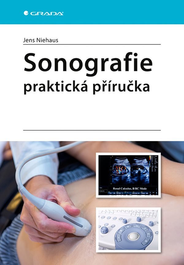 Sonografie - praktická příručka – Niehaus Jens