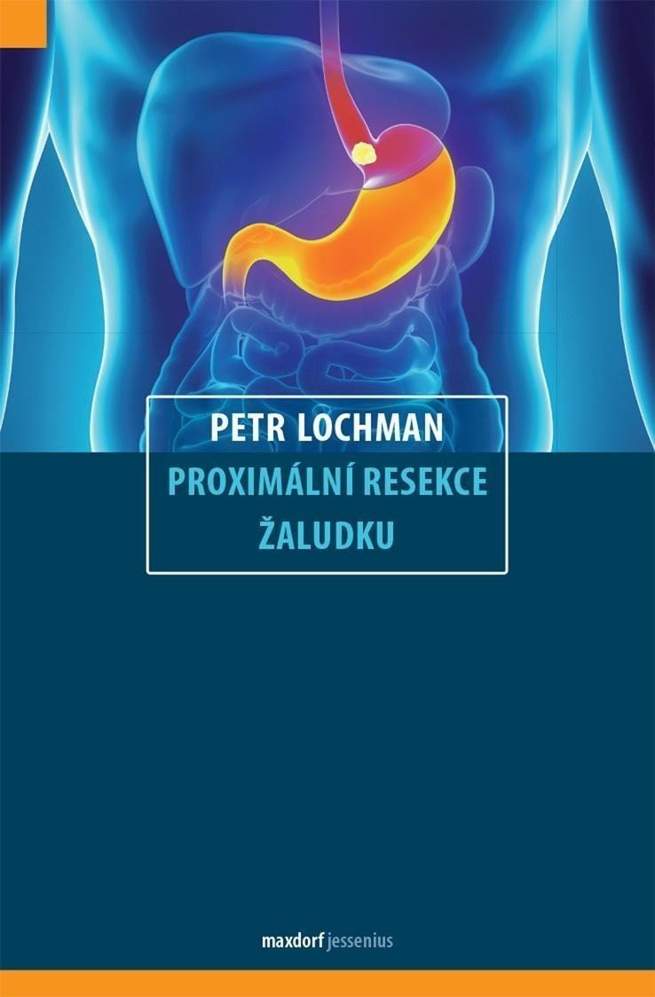 Proximální resekce žaludku – Lochman Petr