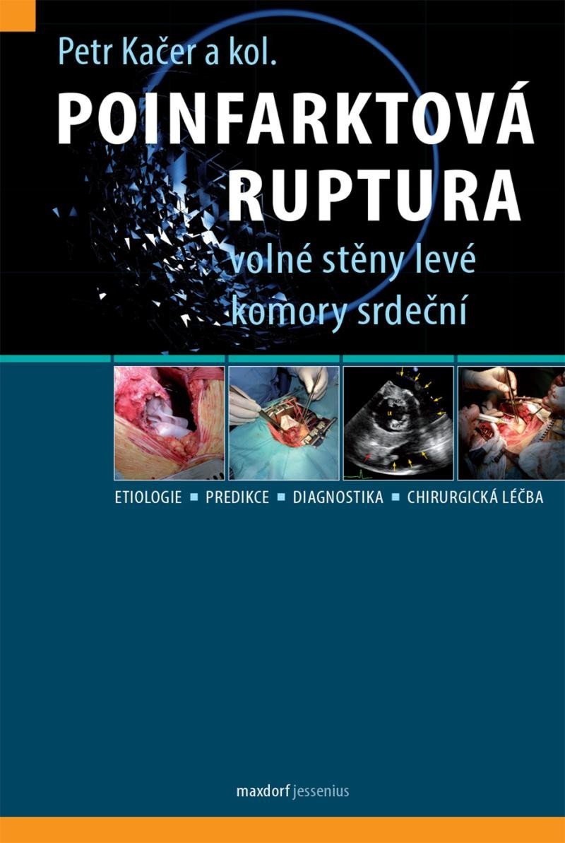 Poinfarktová ruptura volné stěny levé komory srdeční – group of authors