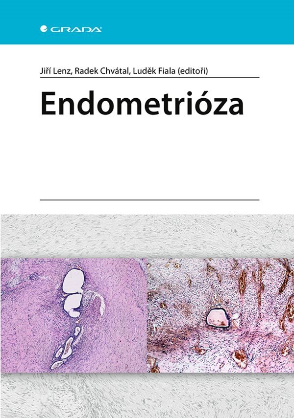 Endometrióza – kolektiv autorů