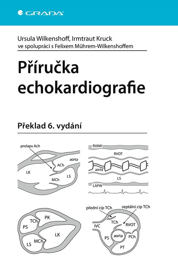 Příručka echokardiografie – Wilkenshoff Ursula