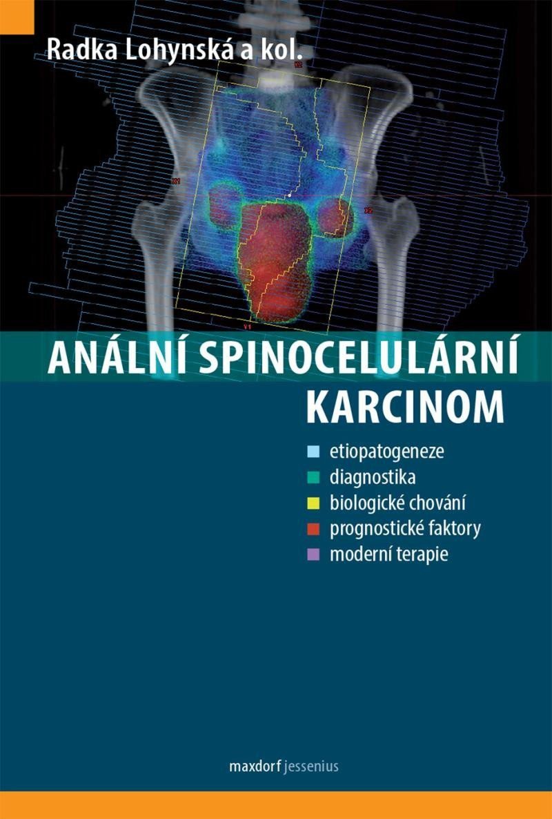 Anální spinocelulární karcinom – group of authors