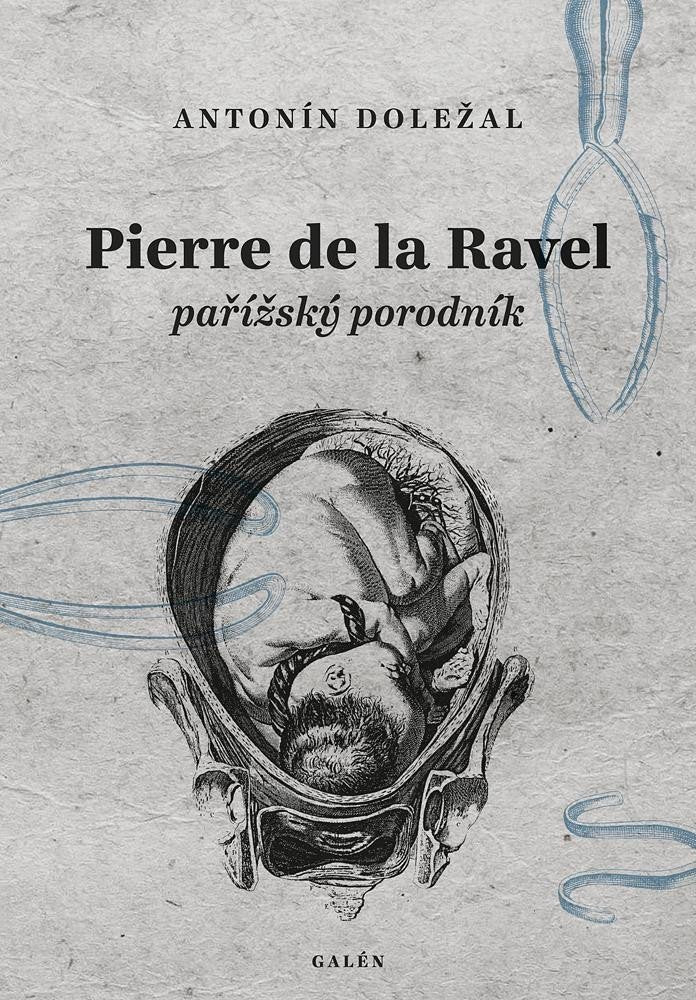 Pierre de la Ravel pařížský porodník – Doležal Antonín